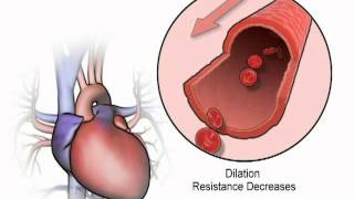 How vasodilators work in heart failure  wwwheartfailuremattersorg [upl. by Tnelc]