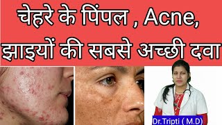 Berberis aquifoliumMedicine for acnepigmentationscars berberisaquifolium shorts acne  pimple [upl. by Mallon]