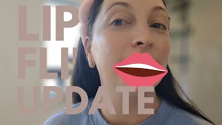 WEEKLY VLOG  lip flip update so far do I love the results speed clean  chaotic afternoon errands [upl. by Maharva]