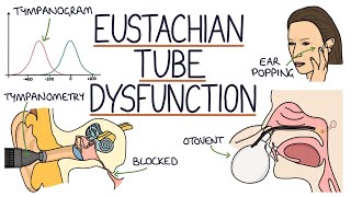 Understanding Eustachian Tube Dysfunction [upl. by Ertnom207]