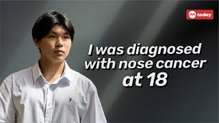 I was diagnosed with nose cancer at 18 [upl. by Attelrahc]