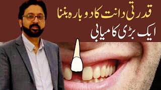 How to REGROW Your Teeth Naturally with a Japanese Research Medicine [upl. by Loginov]