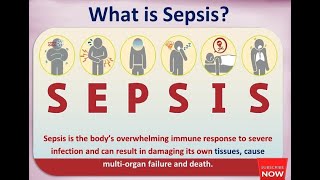 SIRS SEPSIS et CHOC SEPTIQUE 🤩 explication la plus claire Dr Abdellah 🤩 ecn [upl. by Eidua]