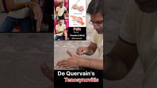 De Quervains tenosynovitis Rehab  De Quervains tenosynovitis Exercises [upl. by Trixi]