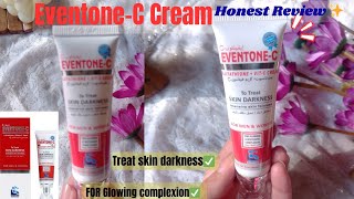 EventoneC Cream  Medicated cream for Skin Whitening 🤩 EventoneC Cream Review✨ [upl. by Moreta]