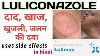 Luliconazole 1ww cream । Lulimac cream । uses side effects in hindi । Luliderm cream [upl. by Etyak100]