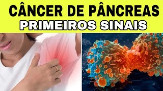 7 Sinais Iniciais de CÂNCER de PÂNCREAS Sintomas de Insulinoma [upl. by Sloatman391]