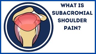 What is subacromial shoulder pain [upl. by Burley82]