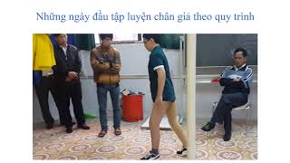 Hemipelvectomy Prosthesis  Chân Giả tháo hoàn toàn xương cánh chậu [upl. by Annahahs]