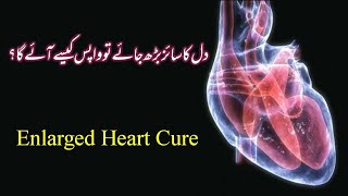 Dil ka size berh jae tou kya is ka ilaj mumkin hai  Increased Heart Size Problem [upl. by Papp]