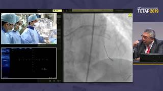 TCTAP 2019 Coronary Symposium  Live Case amp Lecture Session III [upl. by Riay211]