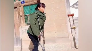 The beautiful woman with polio goes out to work on crutches disability [upl. by Nedgo408]