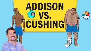 Addisons vs Cushings Disease for NCLEX RN [upl. by Yevreh]