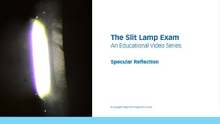 The Slit Lamp Exam – Episode 7 Specular Reflection [upl. by Keverian]