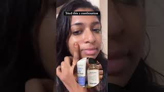 skincare minimalist skincareroutine dailyvlog [upl. by Ydderf]