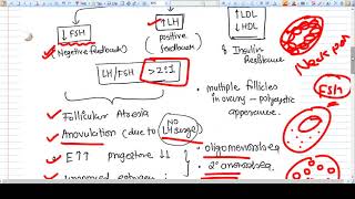 Poly Cystic Ovary Syndrome  Concept [upl. by Irfan]