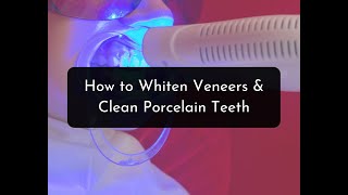 How to Whiten Veneers amp Clean Porcelain Teeth [upl. by Cort246]