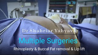 3 Multiple Surgeries by Dr Yahyavi Ethnic Rhinoplasty  Lip Lift  Buccal Fat Pad Removal [upl. by Mehta]