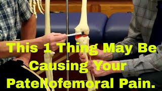 This 1 Thing May Be Causing Your Patellofemoral PainCorrect it NOW [upl. by Weikert]