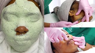 Watch  Full Dermaplaning Facial Treatment [upl. by Doty]