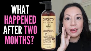 HAIR LOSS SUFFERER TESTS PURA DOR PROFESSIONAL BIOTIN SHAMPOO 8 WEEK REVIEW WITH BEFORE AND AFTER [upl. by Holton]