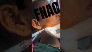 How to do FNAC  fnac biopsy oralsurgery swellingofface facialswellings oralpathology dental [upl. by Ecyar]