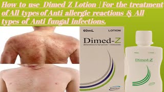 How to use Dimed Z LotionFor the treatment of All types of Anti Allergic reaction amp Anti fungal [upl. by Julina]