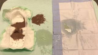 Incontinence Pads vs Cloth Pads [upl. by Accem]