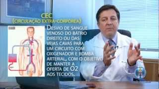 Cirurgia de Revascularização Miocárdica  Doença Arterial Coronariana 1010 [upl. by Skiest419]