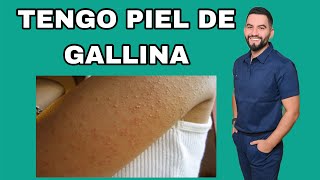 TENGO PIEL DE GALLINA  QUERATOSIS PILARIS  DR DAVID CAMPOS [upl. by Walcott550]