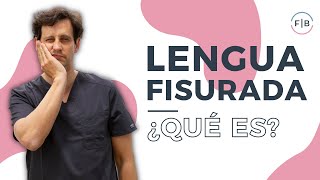 👅¿Qué es la LENGUA FISURADA o AGRIETADA Soluciones para las GRIETAS de la LENGUA😋 [upl. by Sadnak]