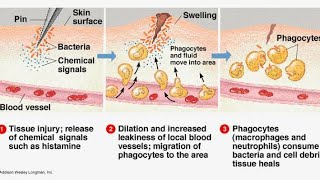 Steps of inflammatory response Mechanism of inflammation youtube shorts [upl. by Ahsaekal44]