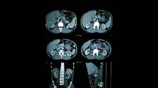 RADIOLOGY EXAM CASES [upl. by Acherman]