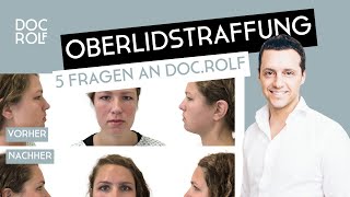 OBERLIDSTRAFFUNG OP bei Schlupflidern [upl. by Paviour384]