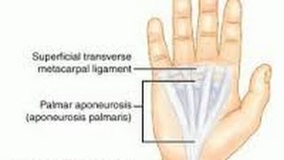 APONEUROSIS  INFLAMACIÓN DE LOS TENDONES DE LA MANO [upl. by Gerg375]