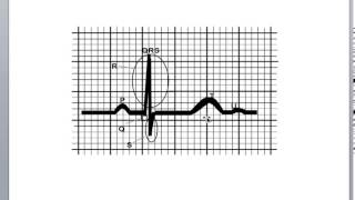 Basic Cardiology Cardiac Cycle Action Potential and the QRS Complex [upl. by Woermer]