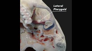 Temporomandibular joint TMJ and its articular disc [upl. by Eissalc]