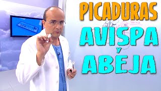 PICADURA DE AVISPA O DE ABEJA ¿Qué síntomas producen ¿Cómo hay que actuar ¿Cómo Prevenirlas [upl. by Minica921]