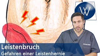 Leistenbruch Warnsignale amp Symptome erkennen  Ursachen amp Therapie einer Leistenhernie [upl. by Gally852]