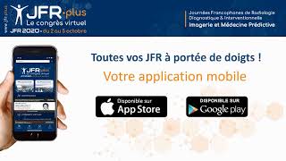 Live JFRplus [upl. by Beryle]