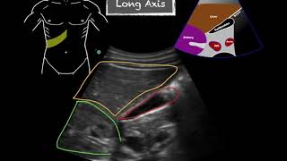 POCUS  Gallbladder Ultrasound Anatomy [upl. by Modie994]