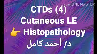 4 Cutaneous LE 👉 Histopathology [upl. by Oryaj]