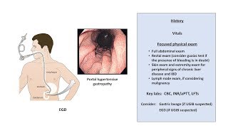 What Happens In Rectal Cancer  Symptoms Causes And Treatment [upl. by Far]