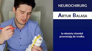 Stenoza kanału kręgowego  neurochirurg Artur Balasa [upl. by Modern]