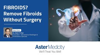 No More Surgeries For Fibroids [upl. by Atul]