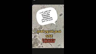 فحص الخروج Stool examination طفيلي Entamoeba Histolytica trophozoite [upl. by Zedecrem]