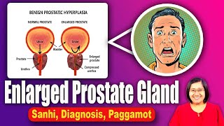 Enlarged Prostate Signs Symptoms Causes Treatments Mens Health  Tagalog Health  Nurse Dianne [upl. by Tal]