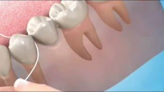 How to use interdental floss [upl. by Iahcedrom]