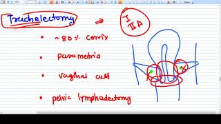 What is TRACHELECTOMY  Brief Idea [upl. by Steep760]