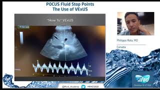 POCUS amp VExUS and fluid stop points P Rola [upl. by Gloriana595]